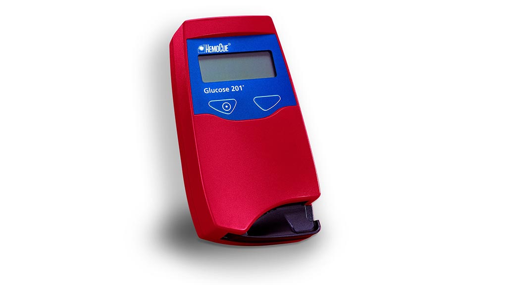 Perioperative glucose testing