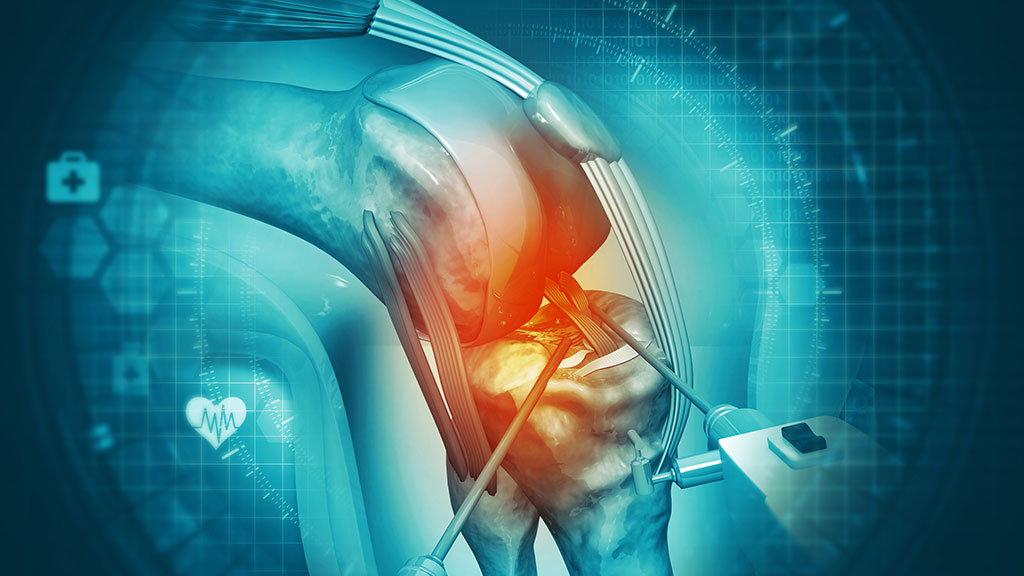 Shoulder Anesthesia Trial